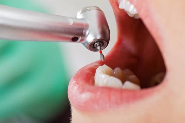 Best Emergency Dental Surgery in Sugar Land, TX